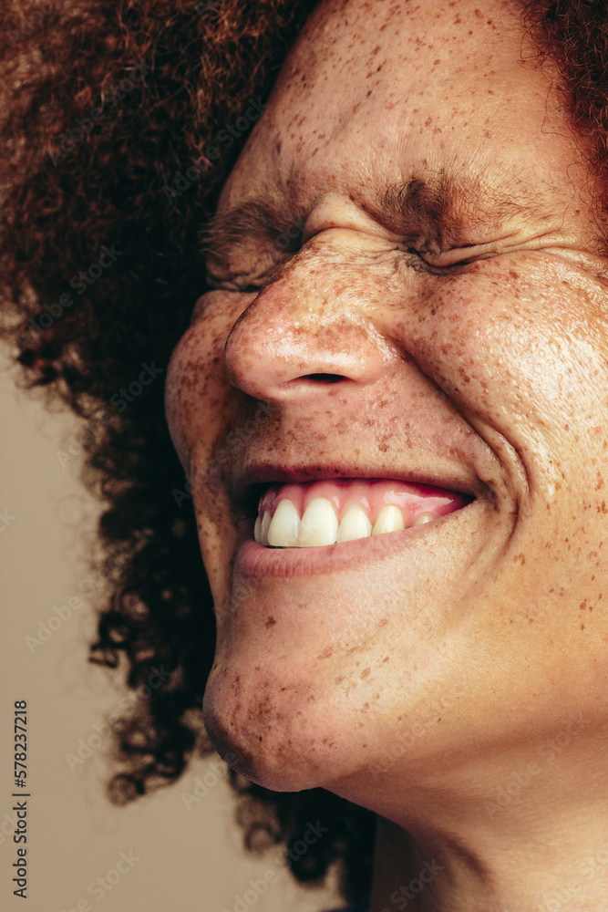 Radiant smile with a freckled face