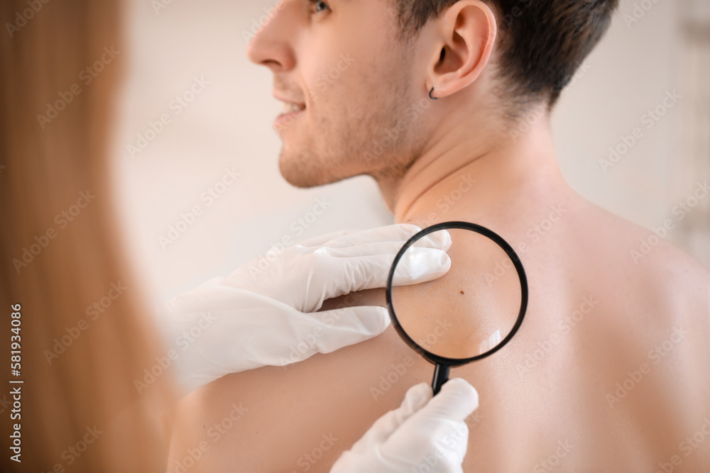 Dermatologist examining mole on young mans back with magnifier in clinic, closeup