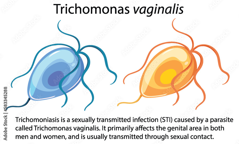 Trichomonas vaginalis with explanation