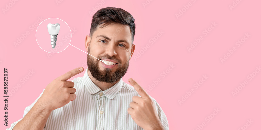 Young man with implanted teeth on pink background