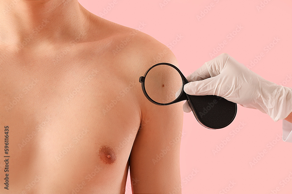 Dermatologist examining mole on young mans shoulder with magnifier against pink background, closeup