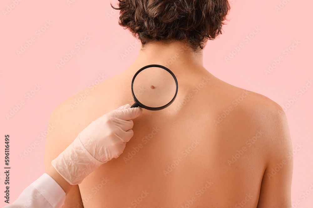 Dermatologist examining mole on young mans back with magnifier against pink background, closeup