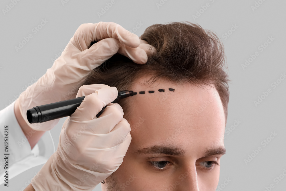 Doctor marking young mans forehead with hair loss problem on grey background, closeup