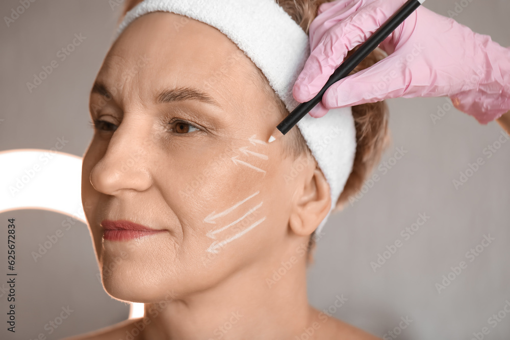 Beautician marking mature womans face for filler injection in salon, closeup