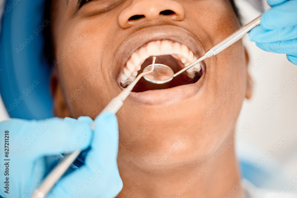 Dentist, black woman mouth and patient at a clinic with medical and healthcare for teeth cleaning. M