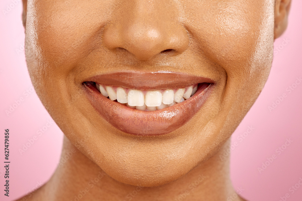 Woman, mouth and healthy smile in studio for dentistry, teeth whitening or veneers by pink backgroun