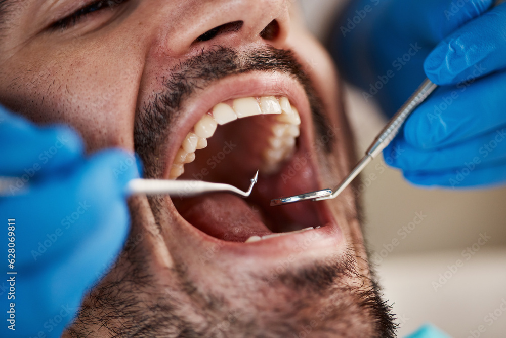 Mouth, man and hands of dentist with tools for dental, healthcare or check in clinic. Oral wellness,