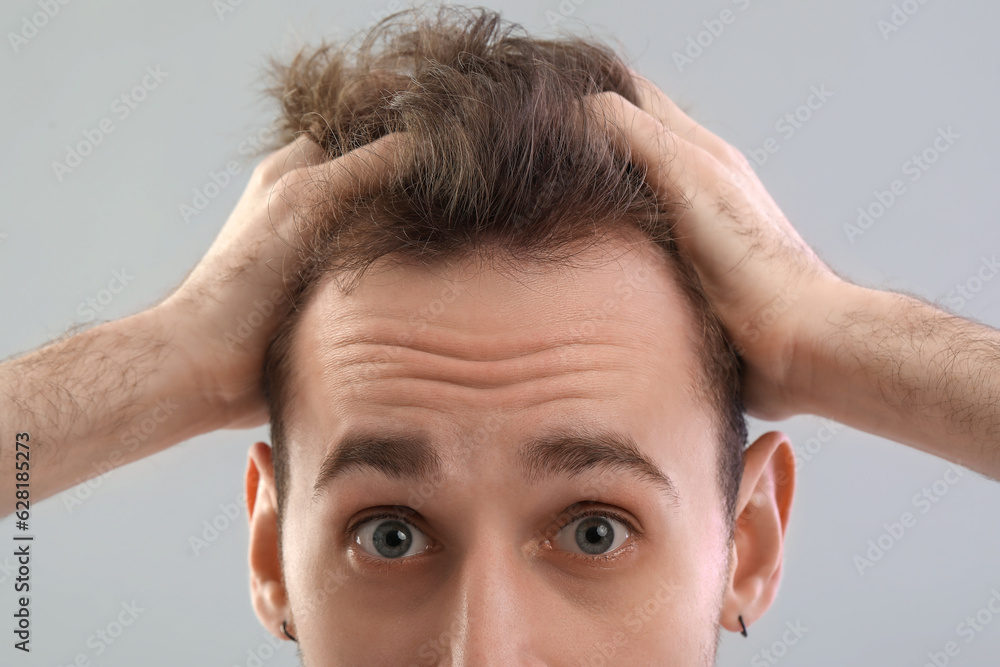 Shocked young man with hair loss problem on grey background, closeup