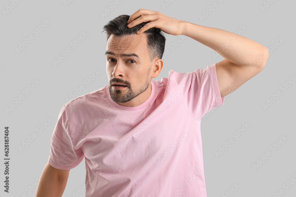 Worried young man with hair loss problem on grey background