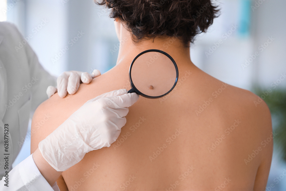 Dermatologist examining mole on young mans back with magnifier in clinic, closeup