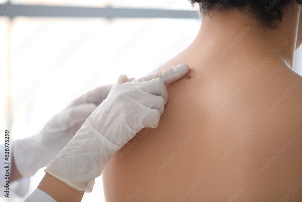 Dermatologist examining mole on young mans back in clinic, closeup