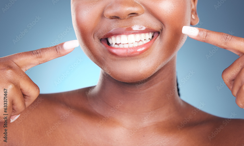 Happy woman, teeth and pointing in dental cleaning, hygiene or treatment against a blue studio backg