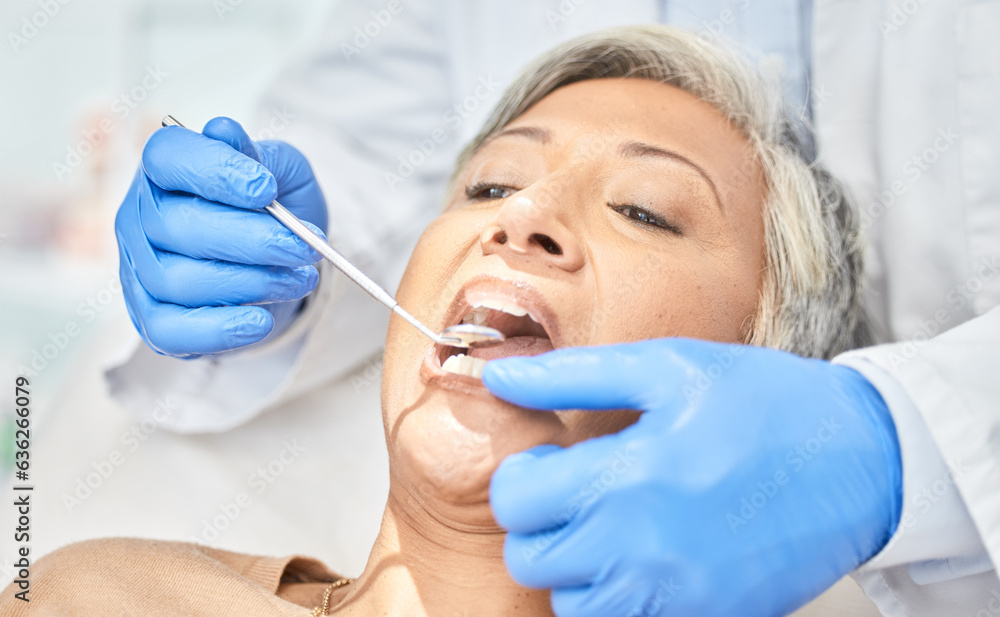 Woman, mirror and hands of dentist cleaning, check and dental wellness in clinic. Oral, orthodontics