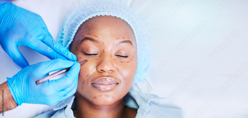 Plastic surgery, pen and black woman sleep on a hospital bed with dermatology with mockup space. Sur