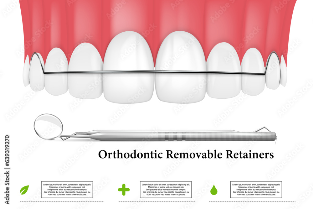 3d render of jaw with orthodontic removable retainer over whte background