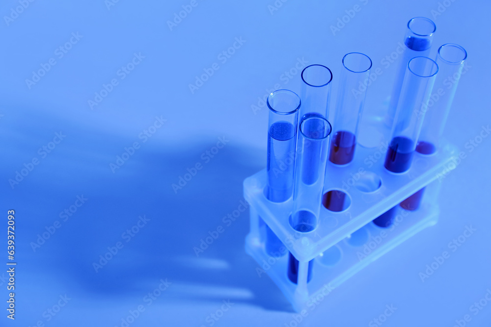 Test tubes with different samples in stand on colorful background