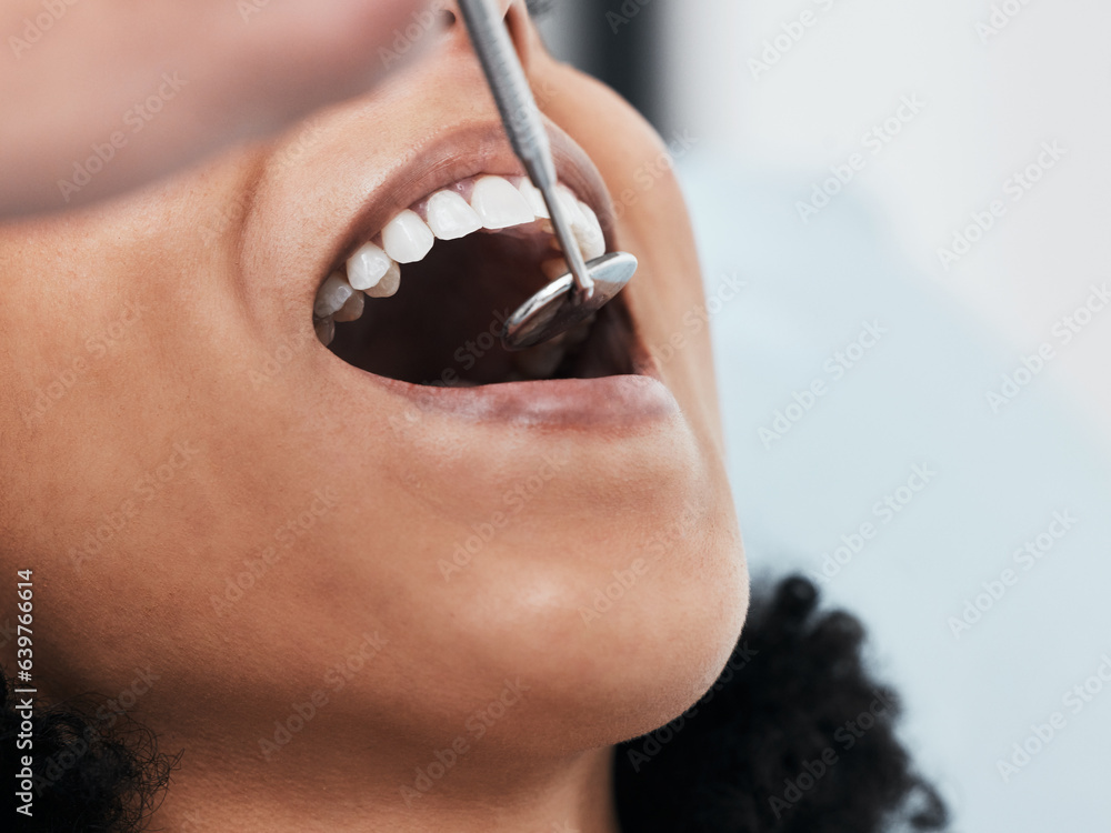 Mouth, teeth of woman and dentist with tools for dental cosmetics, healthcare assessment and test in