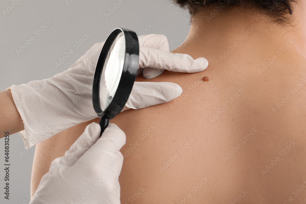 Dermatologist examining mole on young mans back with magnifier against grey background, closeup