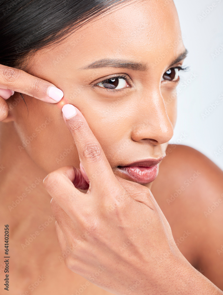 Face, woman and squeeze acne in studio of glowing spot, breakout or check dermatology on white backg