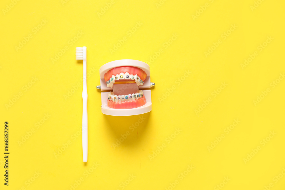 Model of jaw with dental braces and toothbrush on yellow background